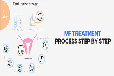 Australian Concept Infertility IVF Treatment and IVF Procedure in Pakistan